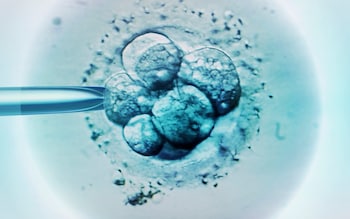 Embryo selection for in vitro fertilisation. The US have created a sperm selection technique that could bypass current laws